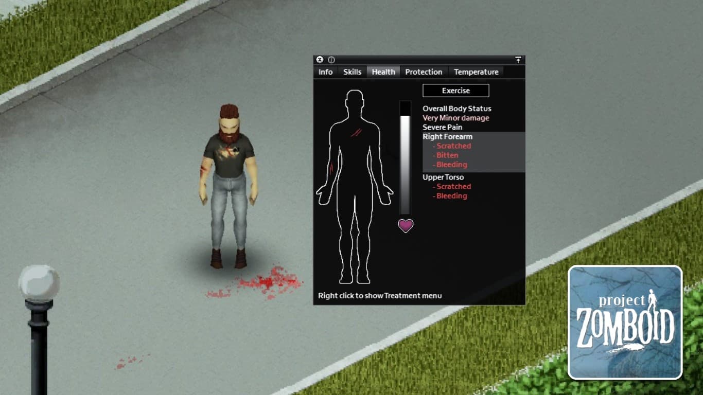 You are currently viewing Project Zomboid – What to Do When Bitten