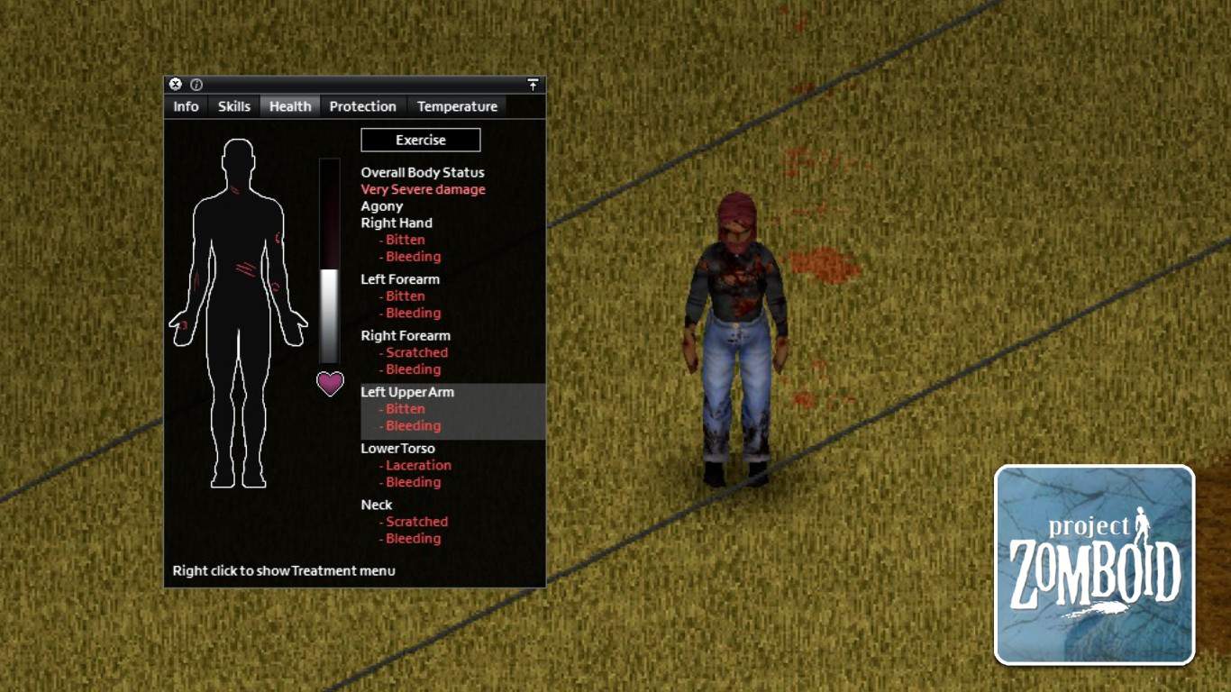 You are currently viewing Project Zomboid – How to Heal Laceration