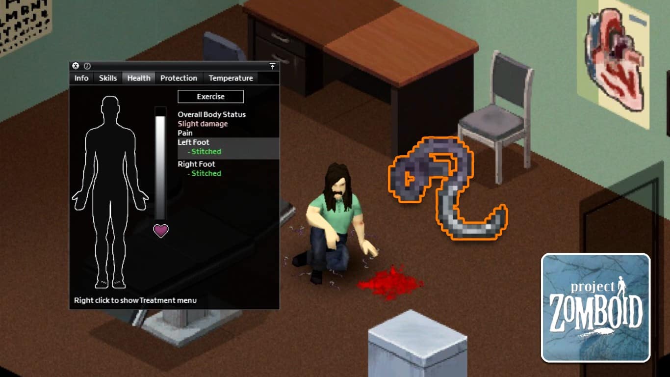 You are currently viewing Project Zomboid – How to Use Suture Needle